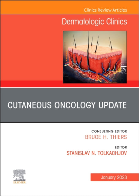 Cutaneous Oncology Update An Issue of