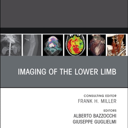 Imaging of the Lower Limb, An Issue of Radiologic Clinics of North America: Volume 61-2