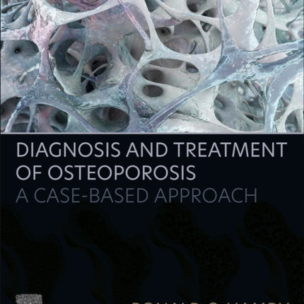 Diagnosis and Treatment of Osteoporosis