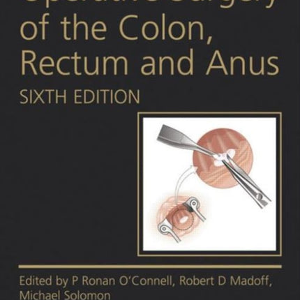 Operative Surgery of the Colon, Rectum and Anus