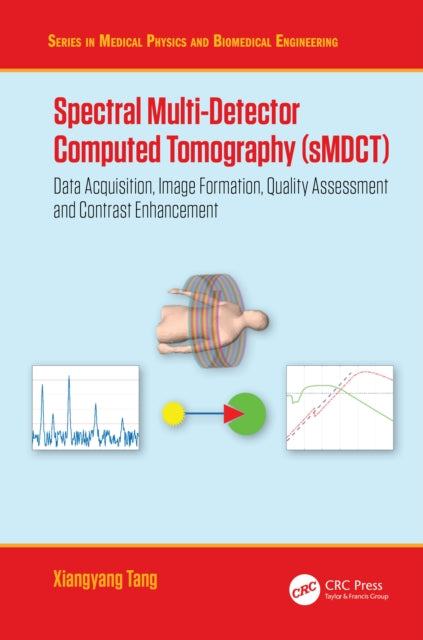 Spectral MultiDetector Computed Tomography sMDCT
