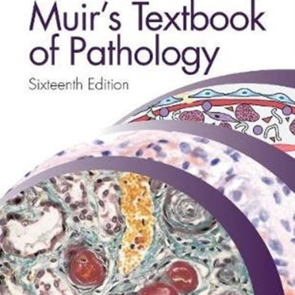 Muir's Textbook of Pathology