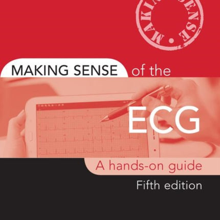 Making Sense of the ECG: A Hands-On Guide