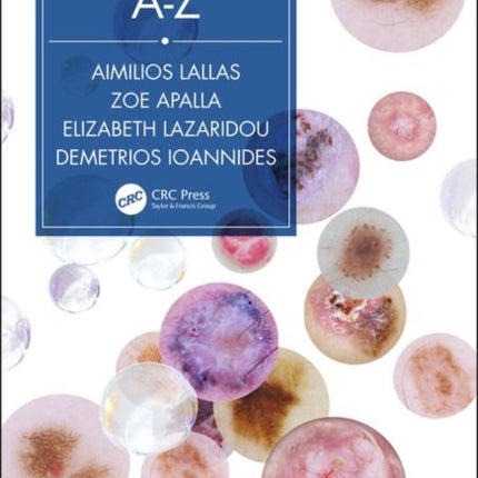 Dermatoscopy A-Z