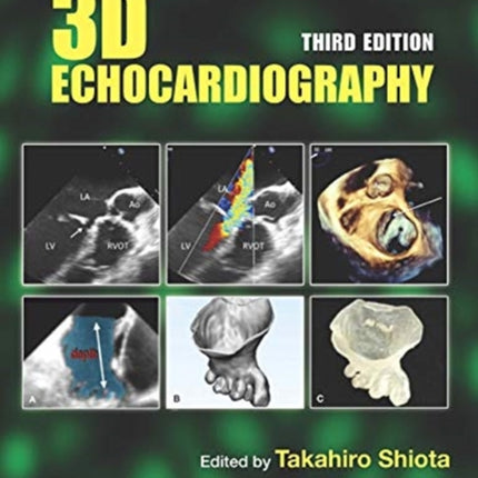 3D Echocardiography