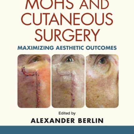 Mohs and Cutaneous Surgery Maximizing Aesthetic Outcomes