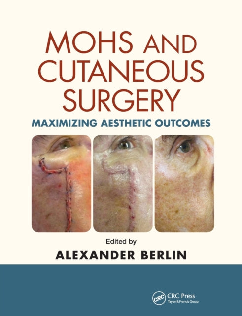 Mohs and Cutaneous Surgery Maximizing Aesthetic Outcomes