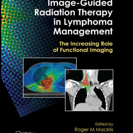 ImageGuided Radiation Therapy in Lymphoma Management The Increasing Role of Functional Imaging