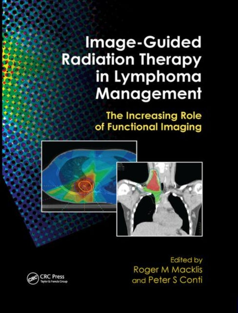 ImageGuided Radiation Therapy in Lymphoma Management The Increasing Role of Functional Imaging