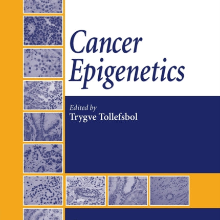 Cancer Epigenetics