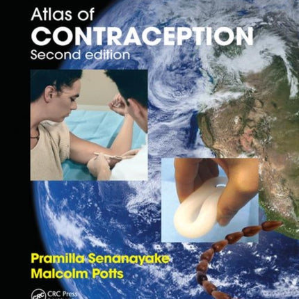Atlas of Contraception