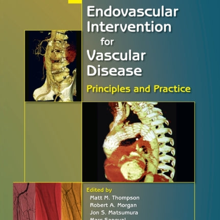 Endovascular Intervention for Vascular Disease