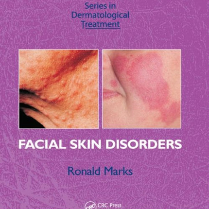 Facial Skin Disorders Series in Dermatological