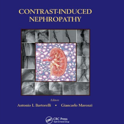 ContrastInduced Nephropathy in Interventional Cardiovascular Medicine