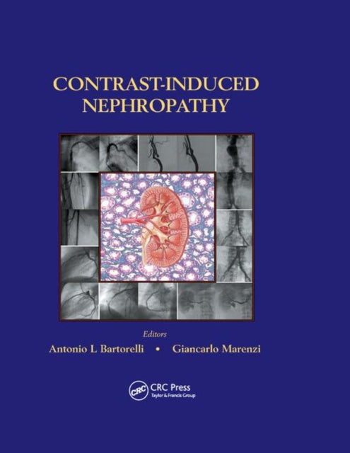 ContrastInduced Nephropathy in Interventional Cardiovascular Medicine
