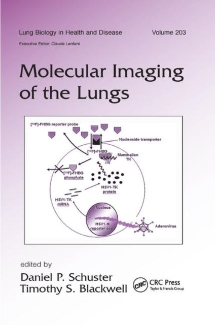 Molecular Imaging of the Lungs