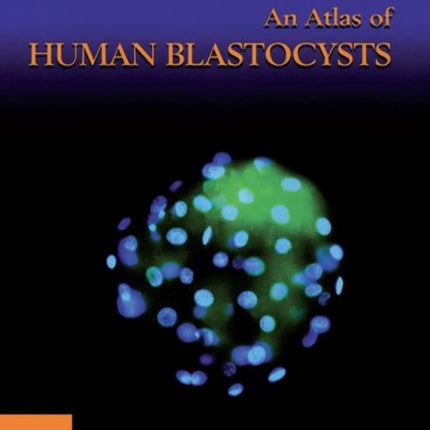 An Atlas of Human Blastocysts Encyclopedia of Visual Medicine Series