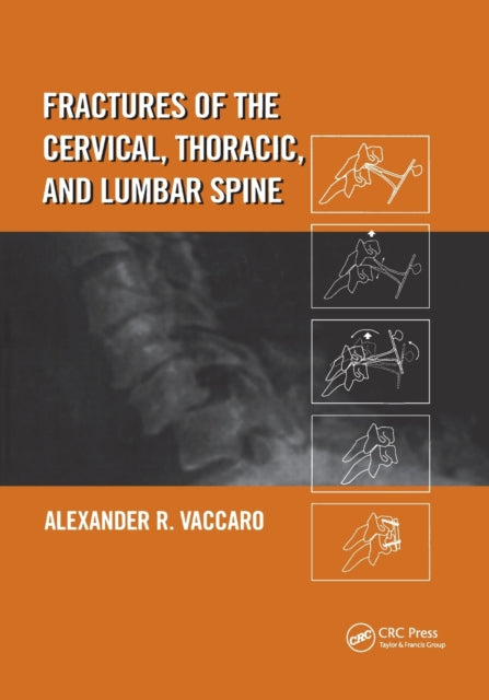 Fractures of the Cervical Thoracic and Lumbar Spine