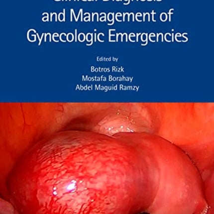 Clinical Diagnosis and Management of Gynecologic Emergencies