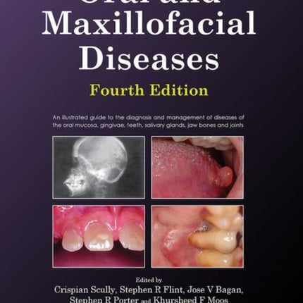 Oral and Maxillofacial Diseases