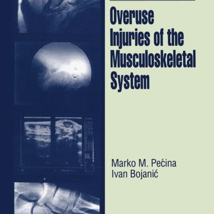 Overuse Injuries of the Musculoskeletal System