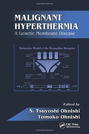 Malignant Hyperthermia A Genetic Membrane Disease