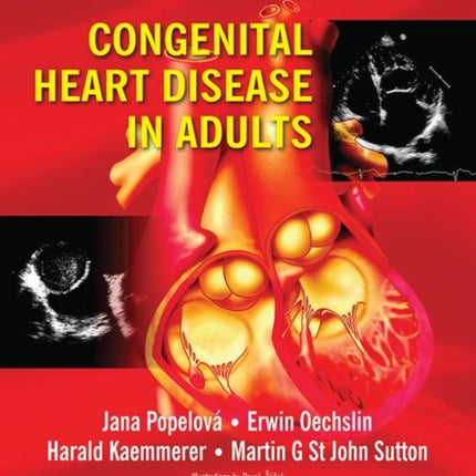 Congenital Heart Disease in Adults