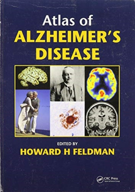 Atlas of Alzheimers Disease