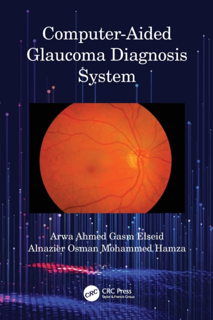 ComputerAided Glaucoma Diagnosis System