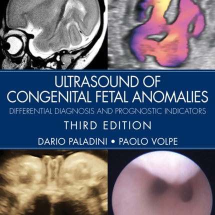 Ultrasound of Congenital Fetal Anomalies