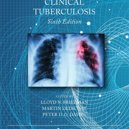 Clinical Tuberculosis