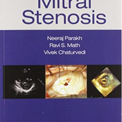 Mitral Stenosis