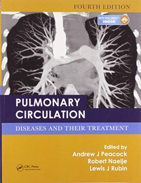 Pulmonary Circulation: Diseases and Their Treatment, Fourth Edition