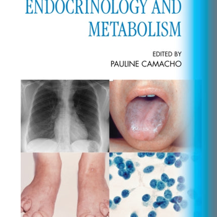 Atlas of Clinical Endocrinology and Metabolism