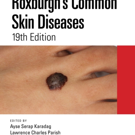 Roxburghs Common Skin Diseases