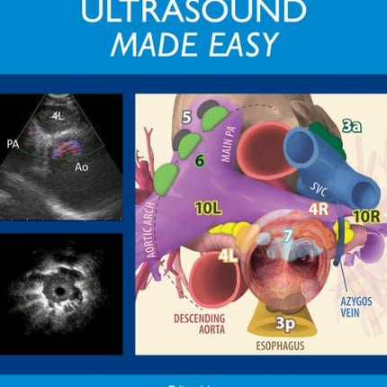 Endobronchial Ultrasound Bronchoscopy Made Easy