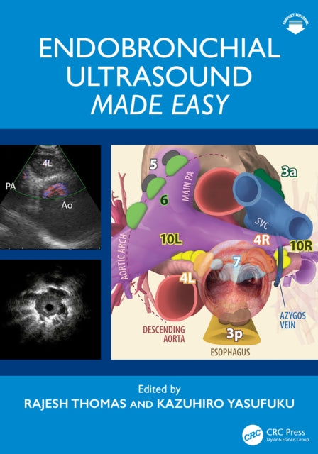 Endobronchial Ultrasound Bronchoscopy Made Easy