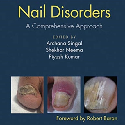 Nail Disorders: A Comprehensive Approach