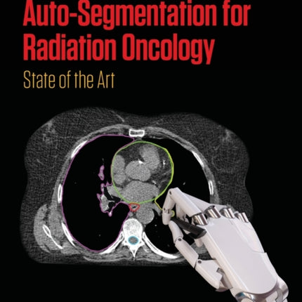 AutoSegmentation for Radiation Oncology