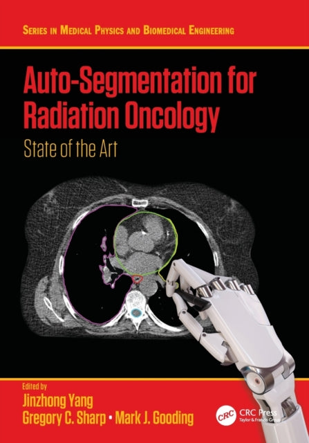 AutoSegmentation for Radiation Oncology