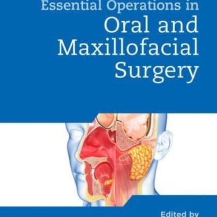 Bailey & Love's Essential Operations in Oral & Maxillofacial Surgery