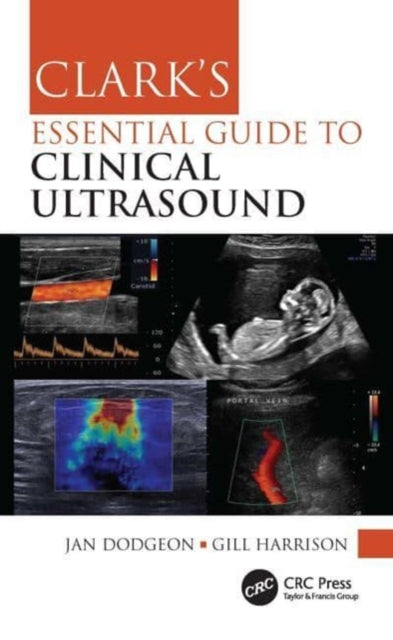 Clarks Essential Guide to Clinical Ultrasound