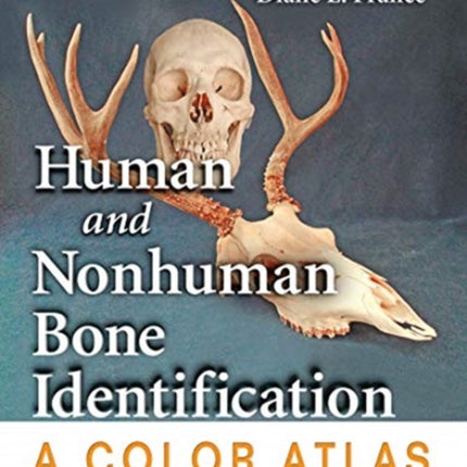 Human and Nonhuman Bone Identification