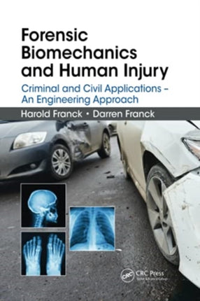 Forensic Biomechanics and Human Injury