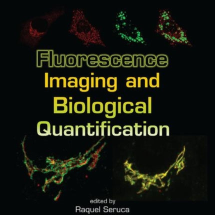 Fluorescence Imaging and Biological Quantification