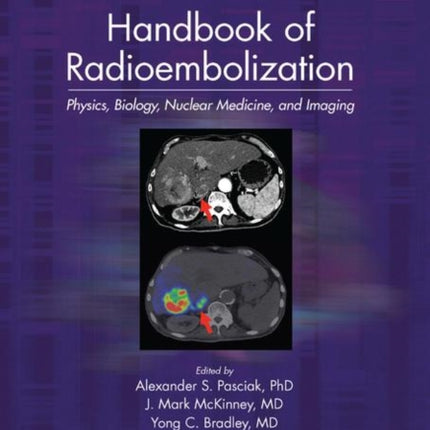 Handbook of Radioembolization