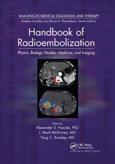 Handbook of Radioembolization