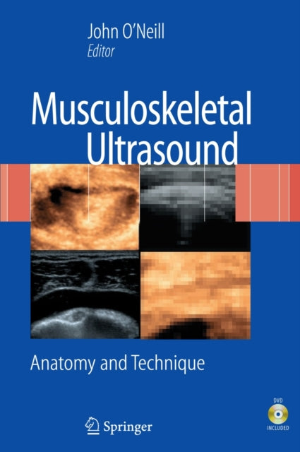 Musculoskeletal Ultrasound Anatomy and Technique