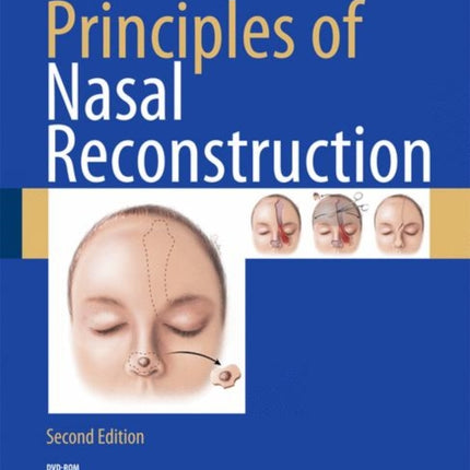 Principles of Nasal Reconstruction