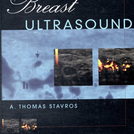 Breast Ultrasound